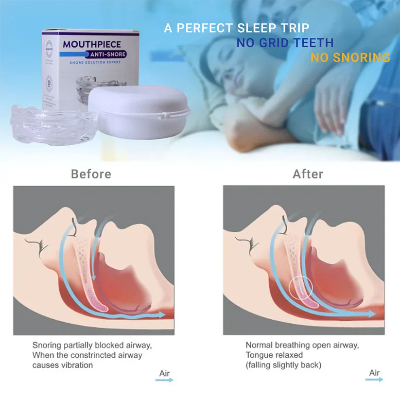 Griqos™ Anti Snoring Mouthpiece - Say goodbye to sleepless nights - Image 7
